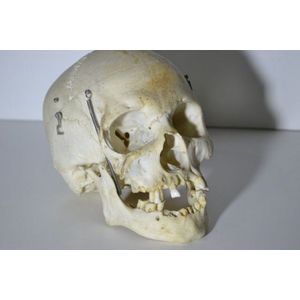 Antique medical skull (ex Tasmanian Doctor Surgery, Hobart)